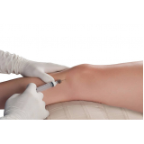injeção com ácido hialurônico no joelho clínica Ibirapuera